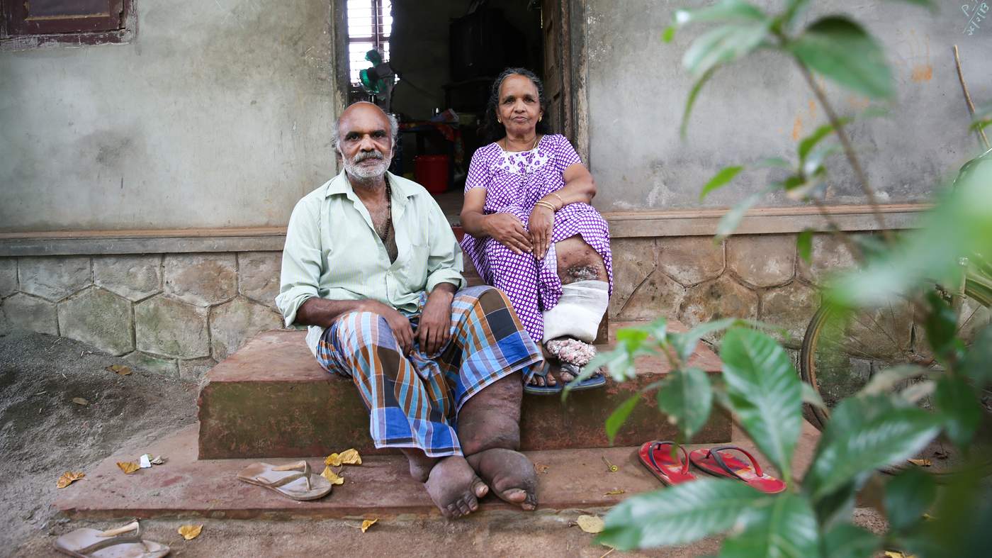 Race to zero: India’s fight against elephantiasis